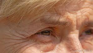 Wrinkles around eye and forhead